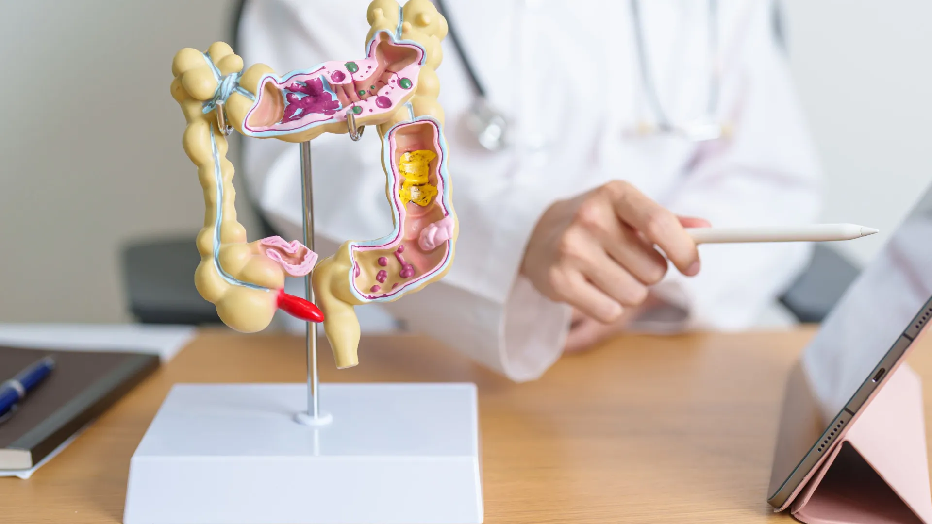 medicamento-comum-mostra-resultados-promissores-contra-cancer-colorretal