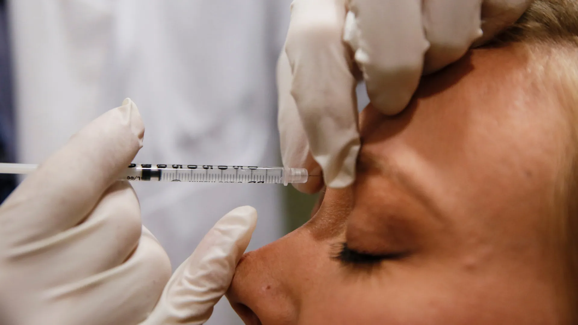 tudo-o-que-voce-precisa-saber-antes-de-aplicar-botox