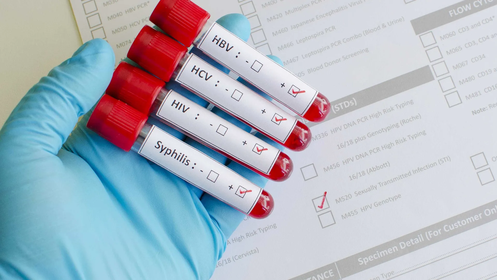 gonorreia-esta-se-tornando-cada-vez-mais-resistente-a-antibioticos,-alerta-a-oms