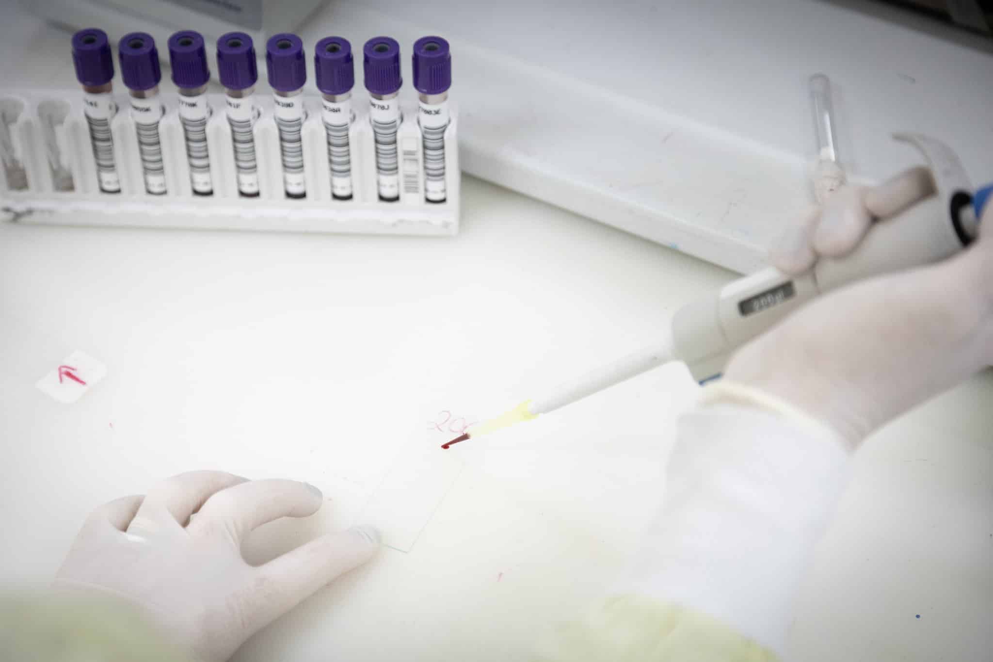sao-paulo-investiga-caso-suspeito-de-ebola-e-mantem-vigilancia-em-saude-no-estado