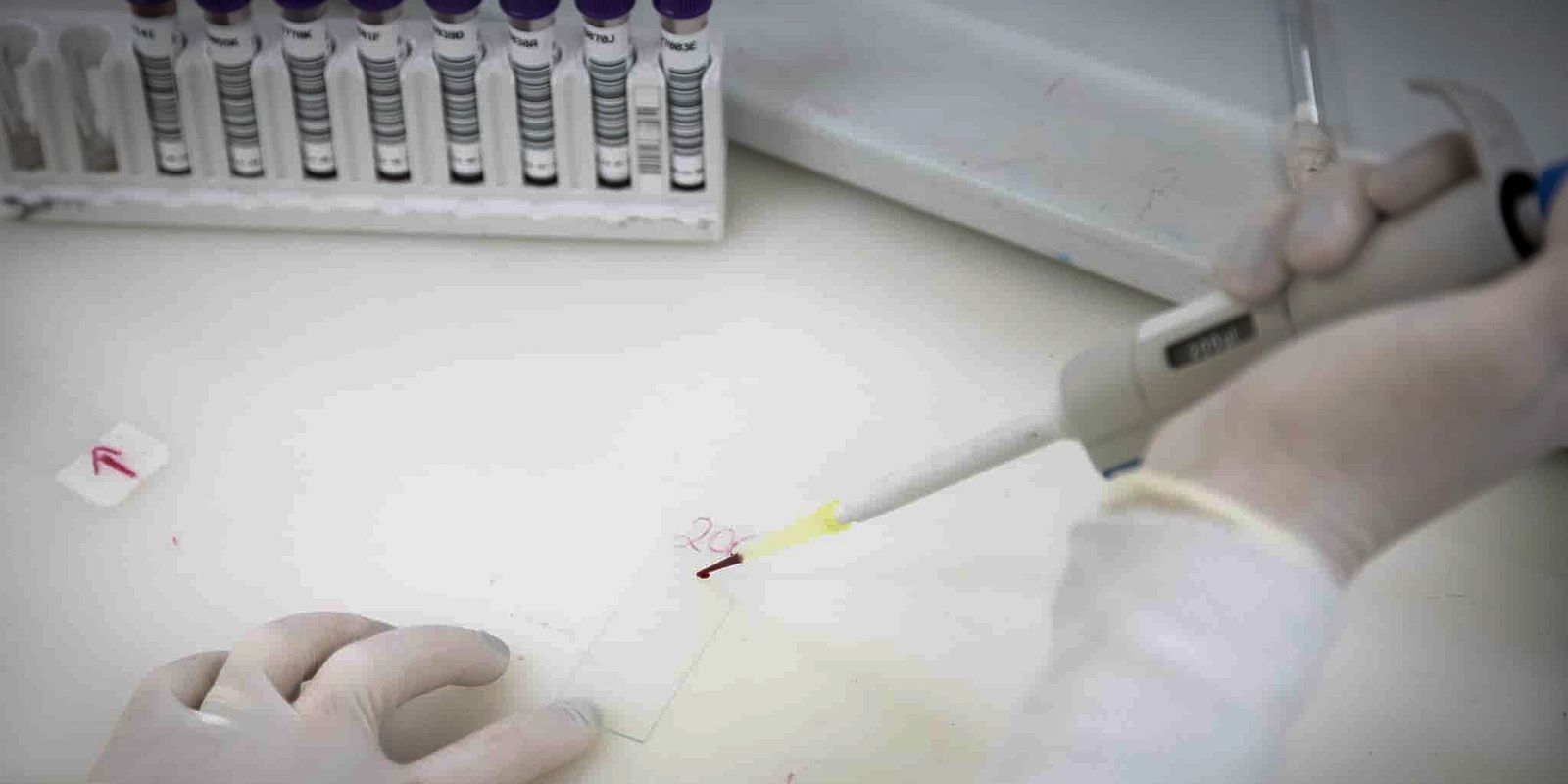 secretaria-de-saude-de-sp-investiga-novo-caso-suspeito-de-ebola