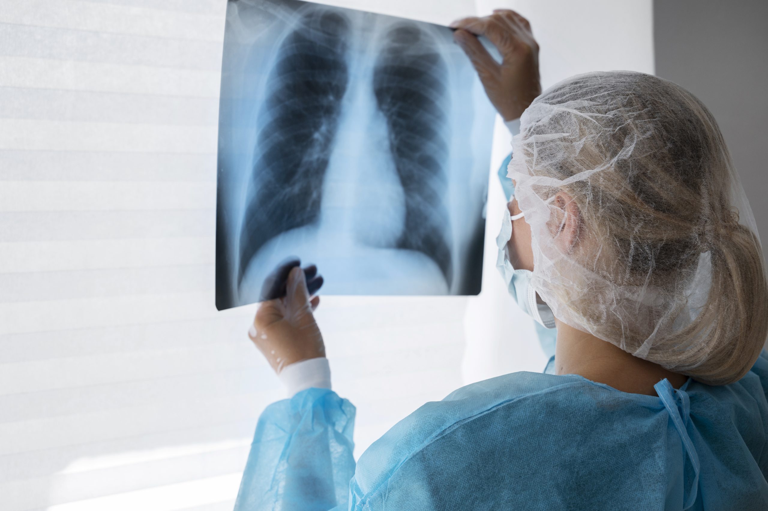 pesquisa-identifica-nova-mutacao-relacionada-ao-cancer-de-pulmao
