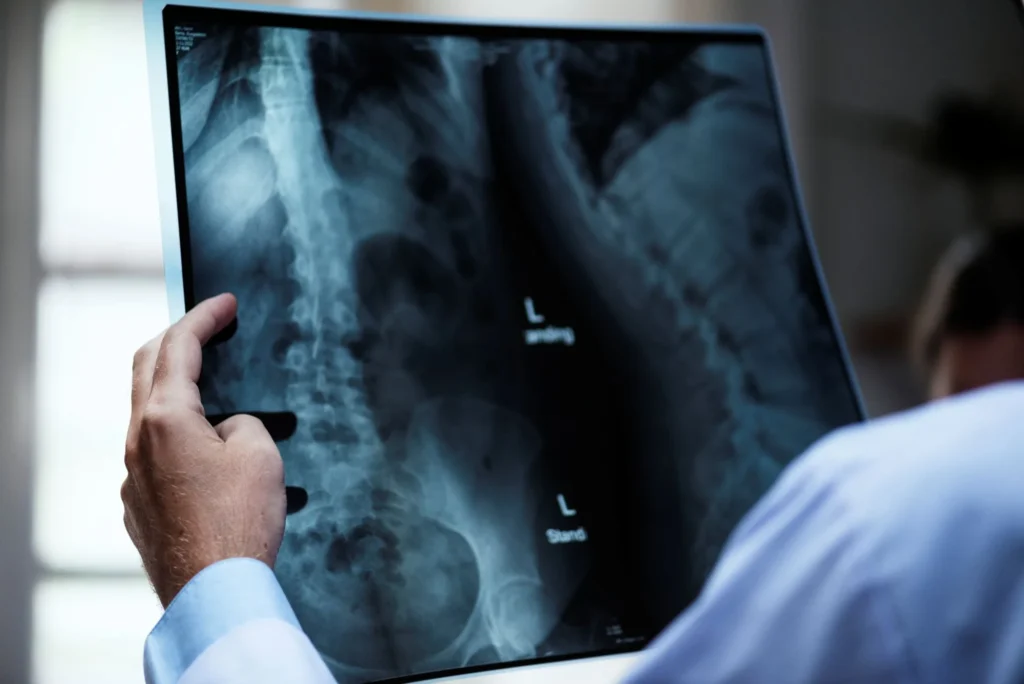 osteoporose-atinge-homens-e-mulheres-de-maneira-diferente;-veja-cuidados